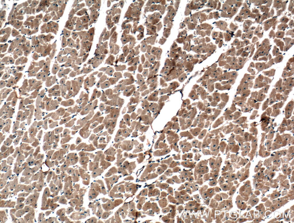 Immunohistochemistry (IHC) staining of human heart tissue using TMEM102 Polyclonal antibody (25505-1-AP)