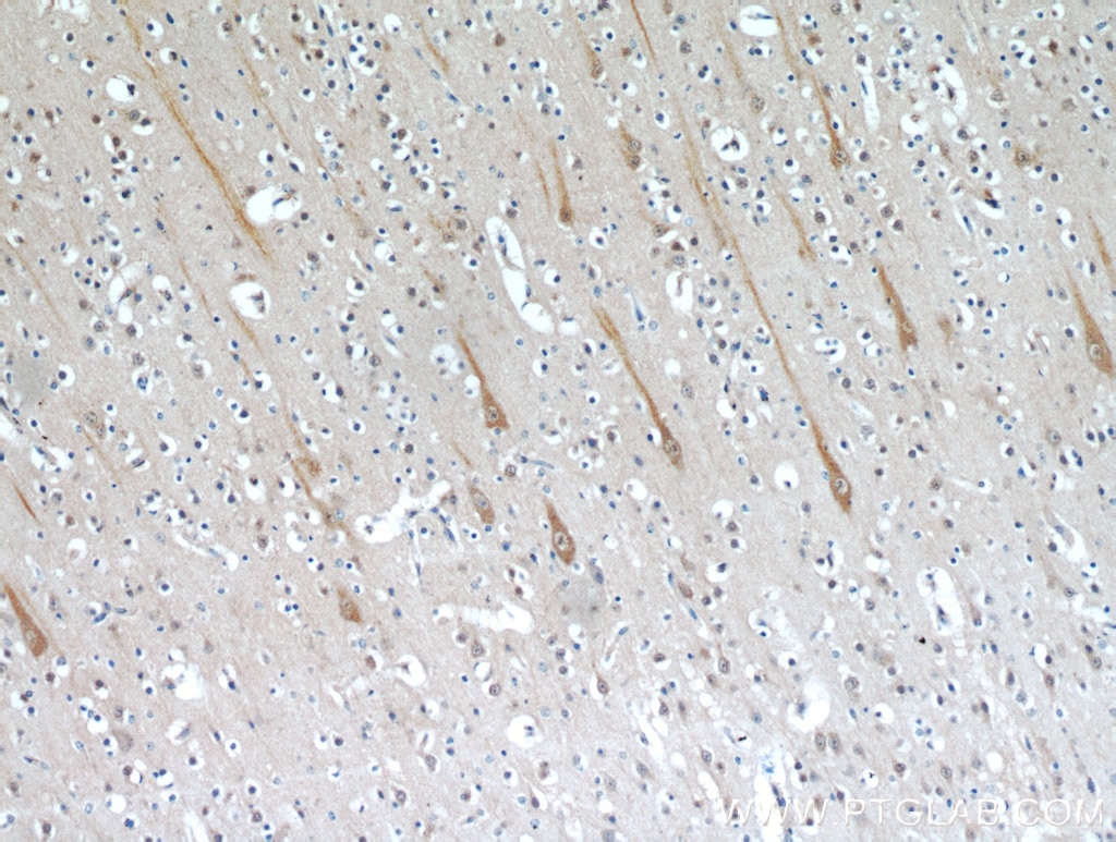 TMEM106B (150-274aa)
