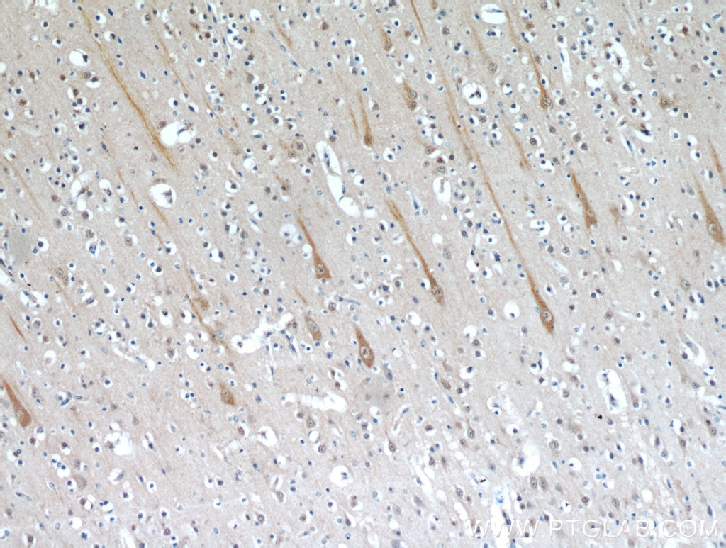 TMEM106B Polyclonal antibody