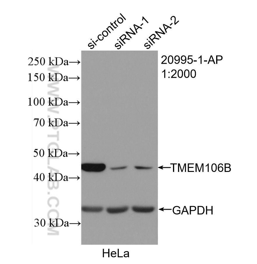 Western Blot (WB) analysis of HeLa cells using TMEM106B Polyclonal antibody (20995-1-AP)