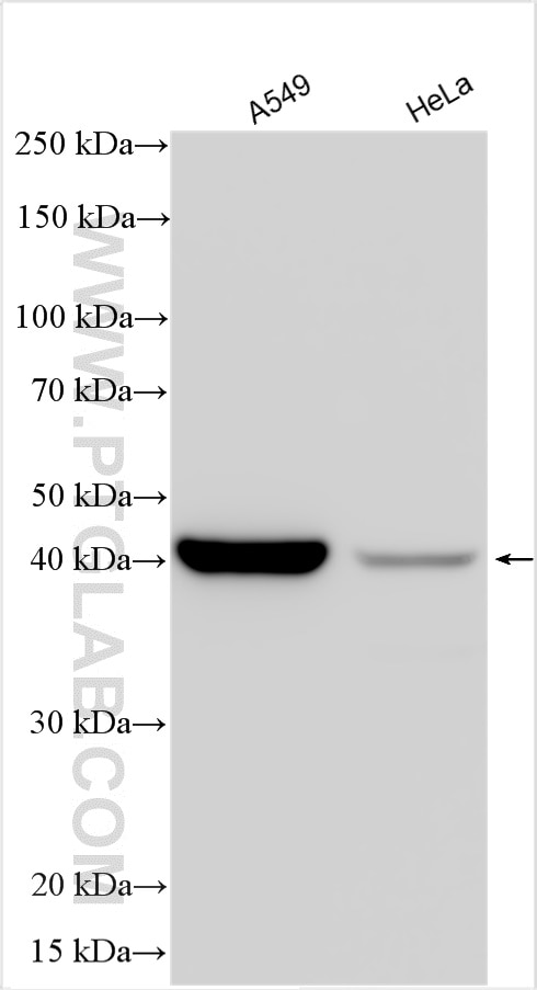 Western Blot (WB) analysis of various lysates using TMEM106B Polyclonal antibody (30301-1-AP)