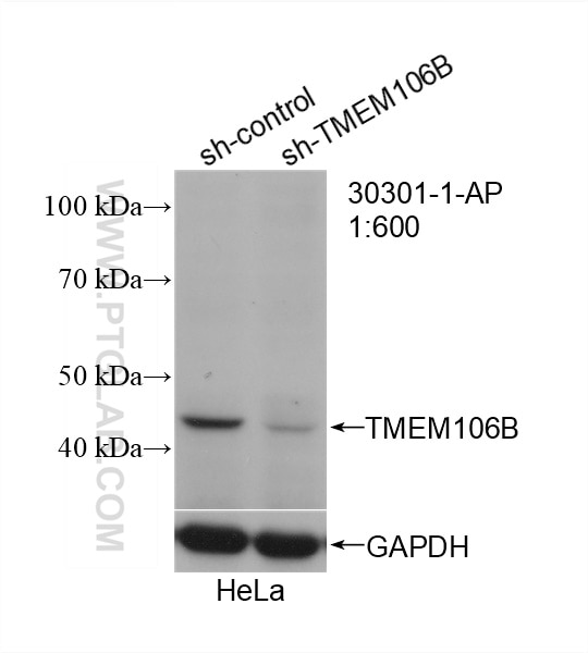 Western Blot (WB) analysis of HeLa cells using TMEM106B Polyclonal antibody (30301-1-AP)