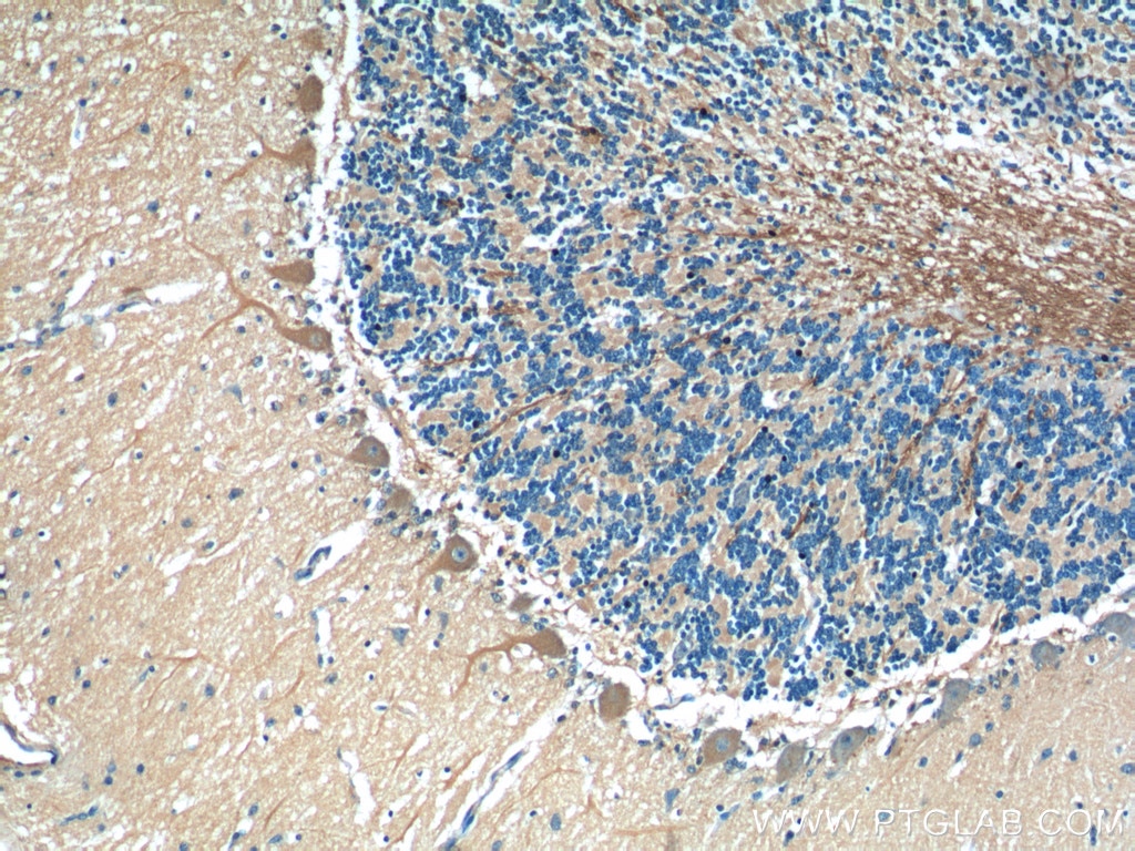 IHC staining of human cerebellum using 60333-1-Ig