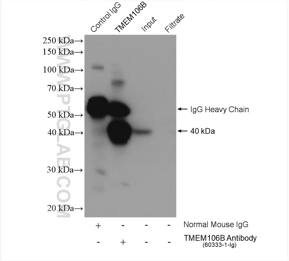 Immunoprecipitation (IP) experiment of HeLa cells using TMEM106B Monoclonal antibody (60333-1-Ig)