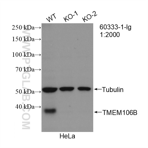Western Blot (WB) analysis of HeLa cells using TMEM106B Monoclonal antibody (60333-1-Ig)