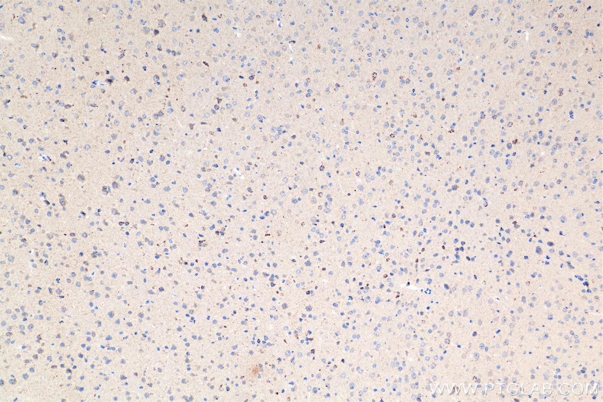 Immunohistochemistry (IHC) staining of mouse brain tissue using TMEM106B Recombinant antibody (84196-3-RR)