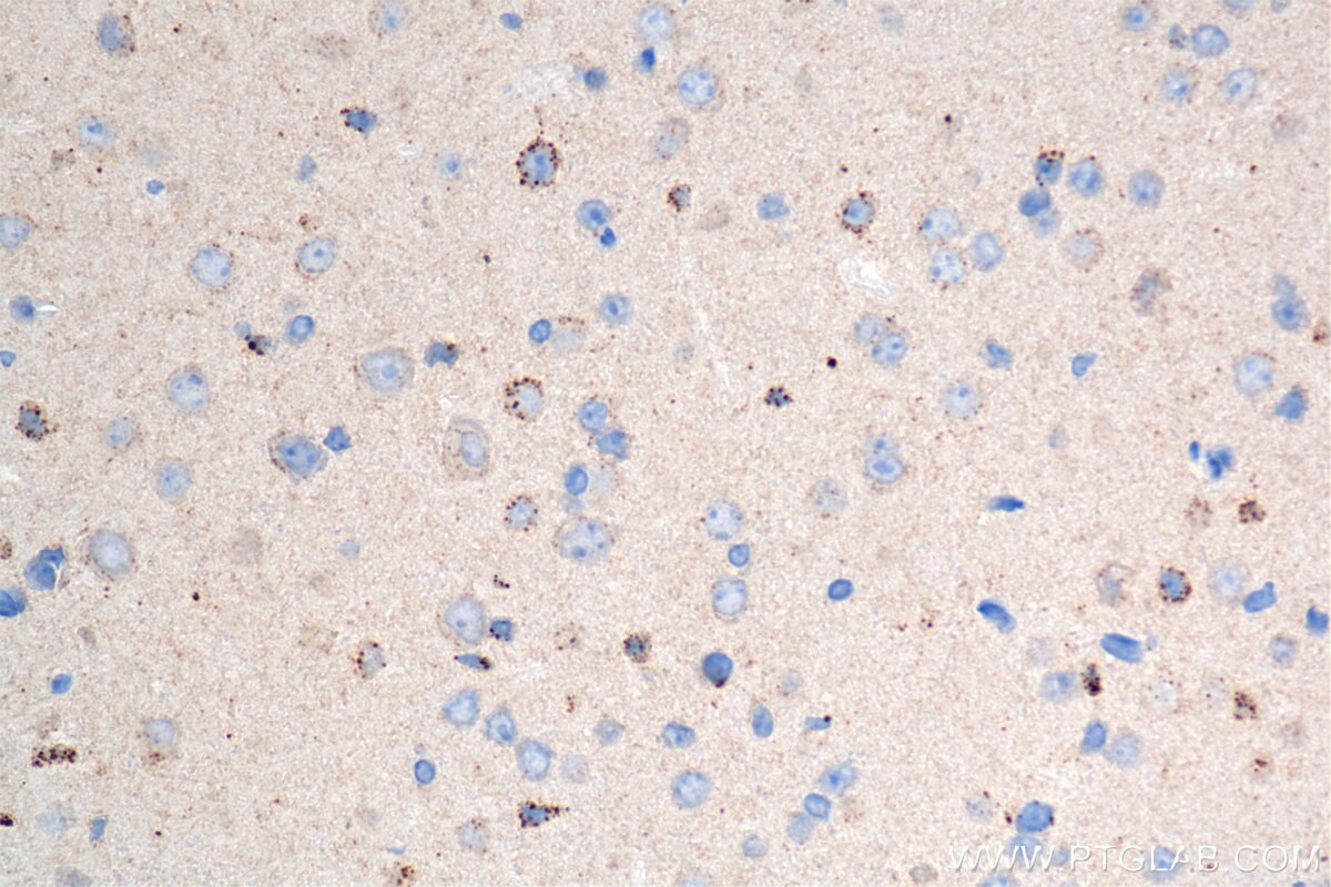 Immunohistochemistry (IHC) staining of mouse brain tissue using TMEM106B Recombinant antibody (84196-3-RR)