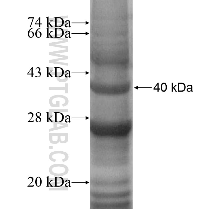TMEM106B fusion protein Ag14264 SDS-PAGE