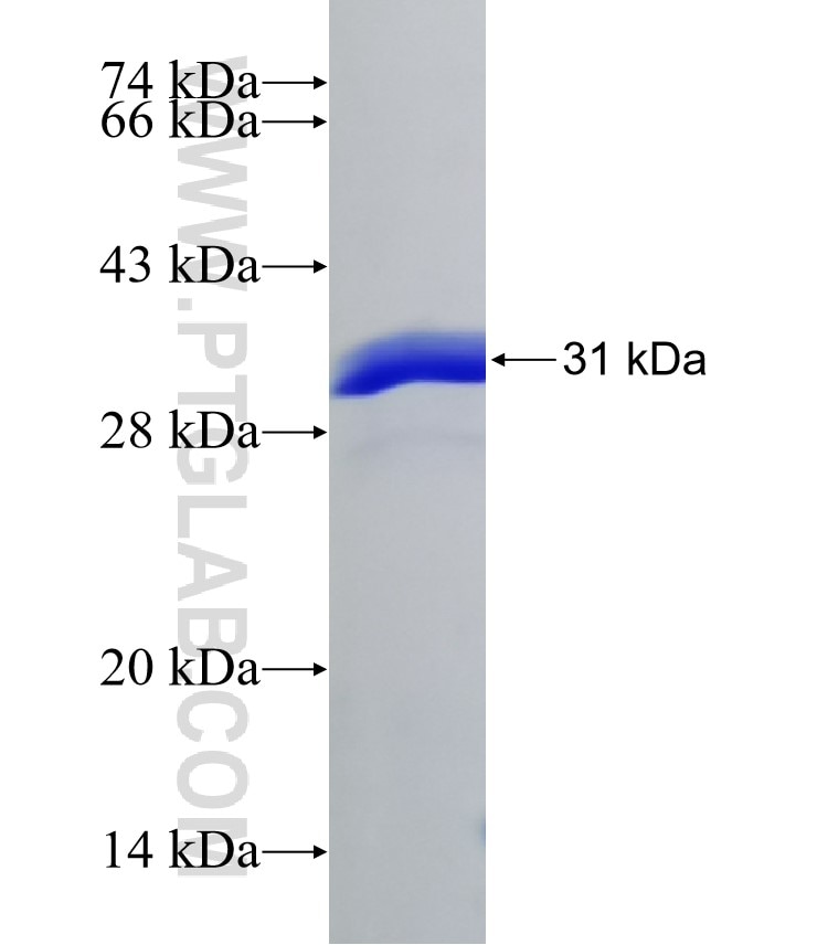 TMEM106B fusion protein Ag21448 SDS-PAGE