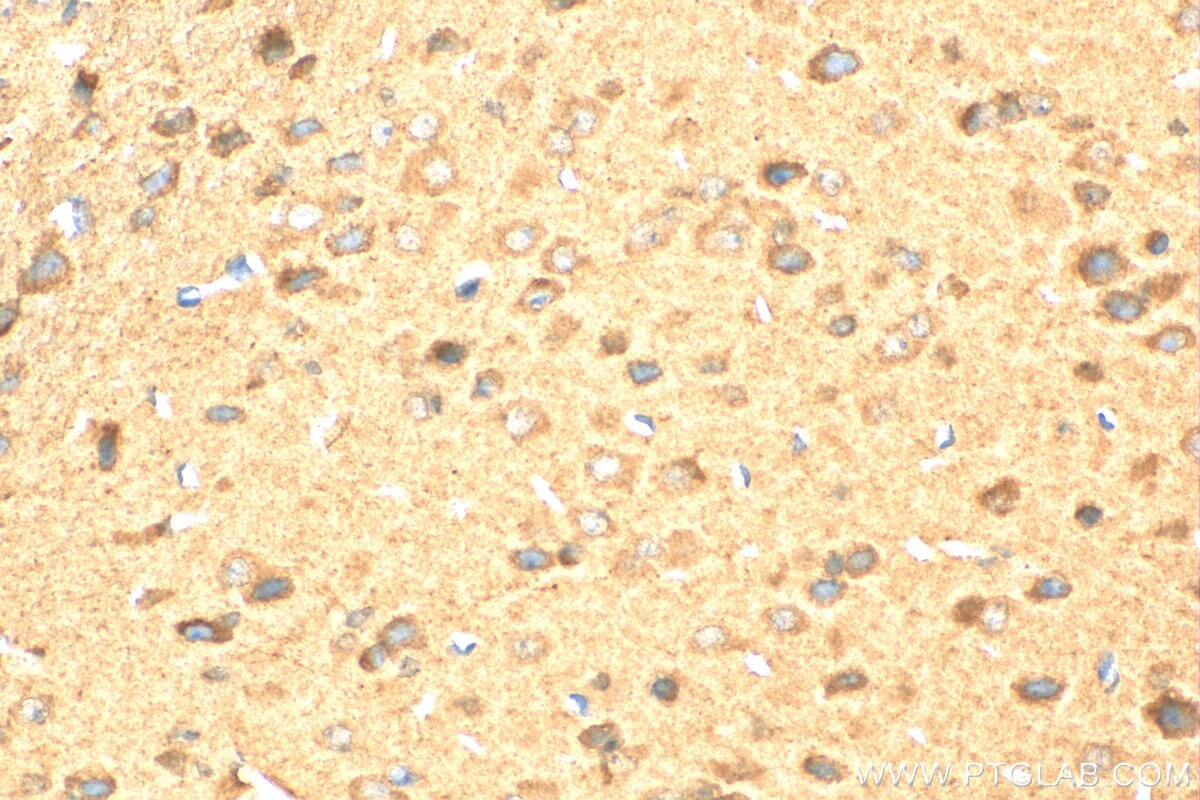 Immunohistochemistry (IHC) staining of mouse brain tissue using Retrolinkin Polyclonal antibody (15177-1-AP)