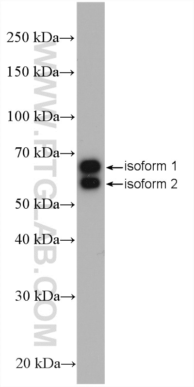 Western Blot (WB) analysis of HeLa cells using Retrolinkin Polyclonal antibody (15177-1-AP)