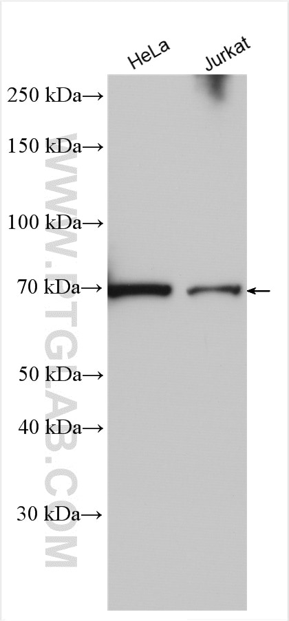 Western Blot (WB) analysis of various lysates using Retrolinkin Polyclonal antibody (15177-1-AP)