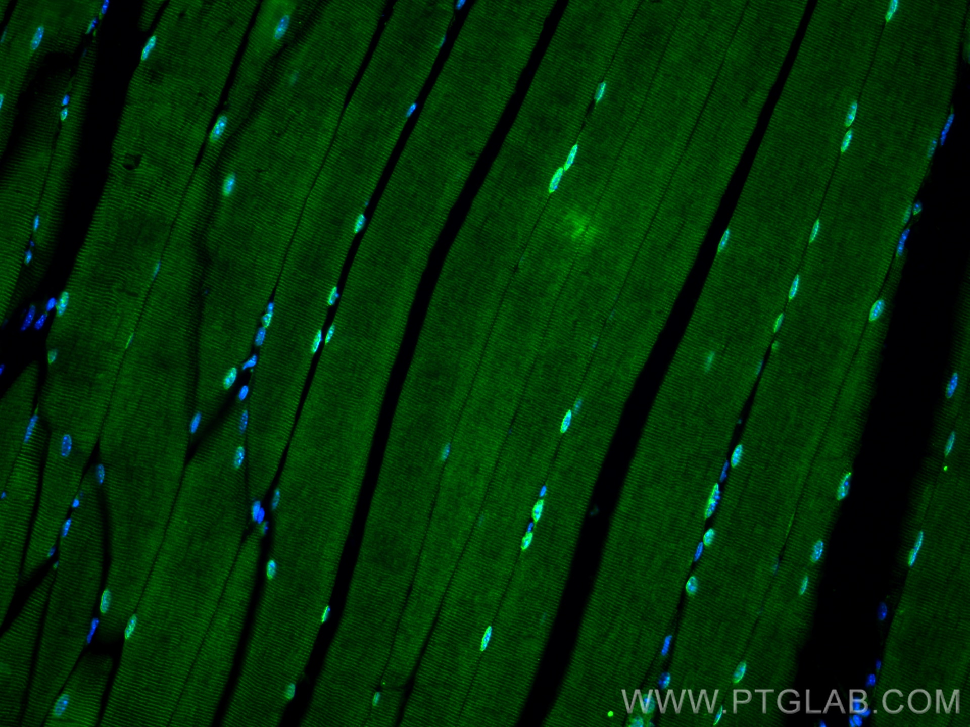 Immunofluorescence (IF) / fluorescent staining of mouse skeletal muscle tissue using TMEM109 Polyclonal antibody (31438-1-AP)