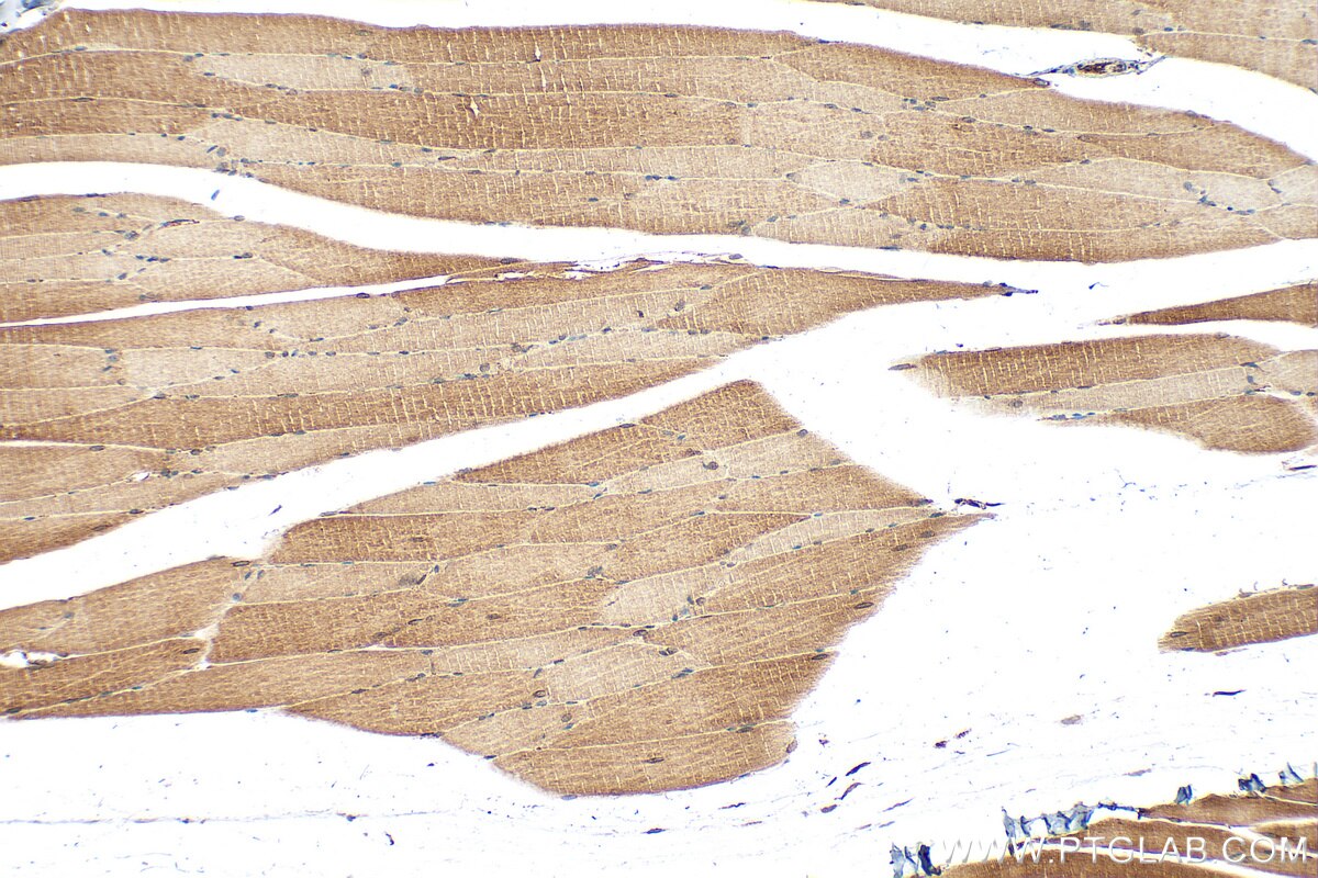 Immunohistochemistry (IHC) staining of mouse skeletal muscle tissue using TMEM109 Polyclonal antibody (31438-1-AP)