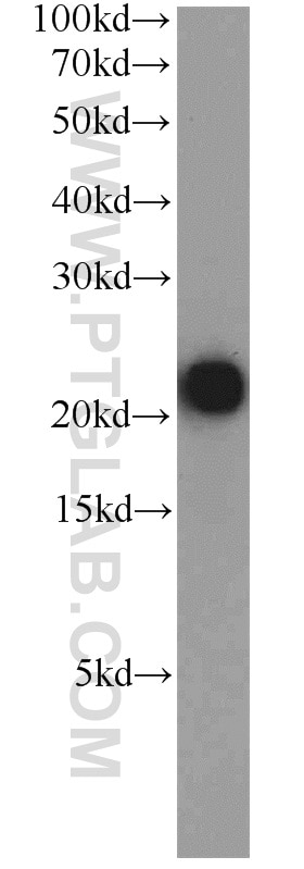 Western Blot (WB) analysis of human placenta tissue using TMEM11 Polyclonal antibody (16564-1-AP)