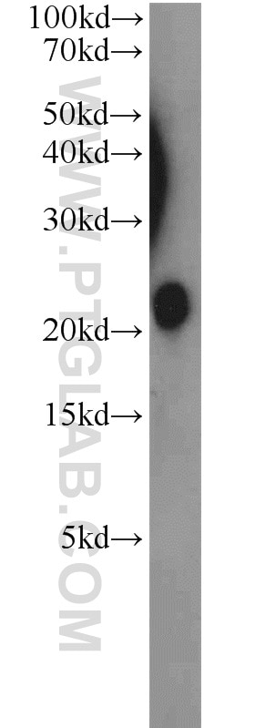 Western Blot (WB) analysis of mouse placenta tissue using TMEM11 Polyclonal antibody (16564-1-AP)