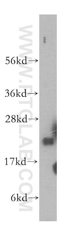 Western Blot (WB) analysis of human placenta tissue using TMEM11 Polyclonal antibody (16564-1-AP)