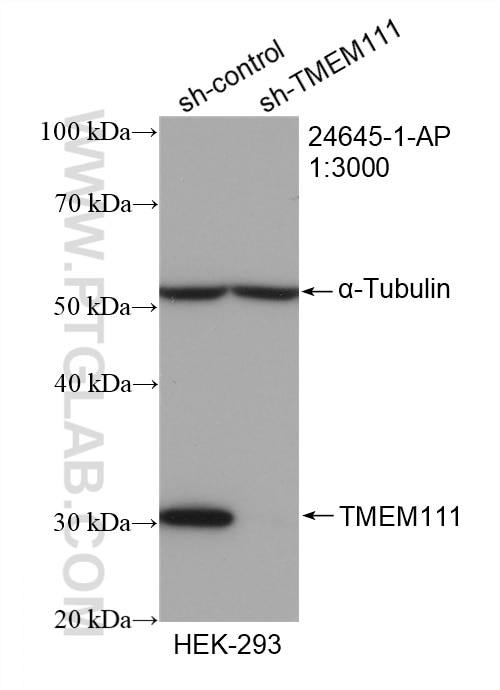 Western Blot (WB) analysis of HEK-293 cells using TMEM111 Polyclonal antibody (24645-1-AP)
