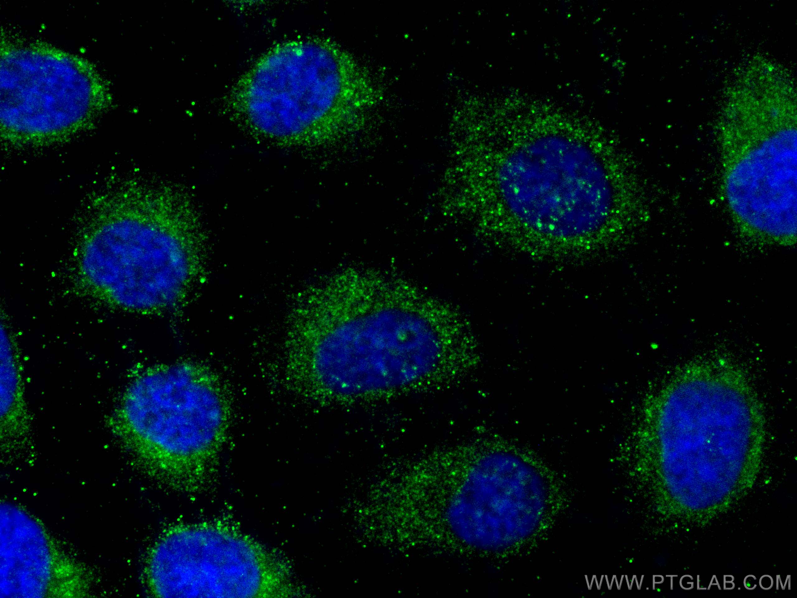 Immunofluorescence (IF) / fluorescent staining of A431 cells using TMEM111 Monoclonal antibody (67205-1-Ig)