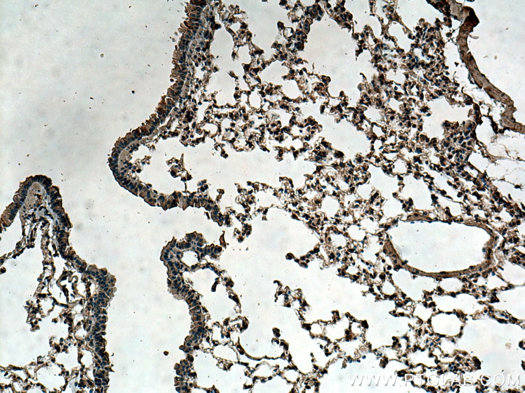 Immunohistochemistry (IHC) staining of mouse lung tissue using TMEM111 Monoclonal antibody (67205-1-Ig)