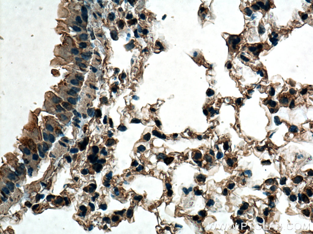 Immunohistochemistry (IHC) staining of mouse lung tissue using TMEM111 Monoclonal antibody (67205-1-Ig)
