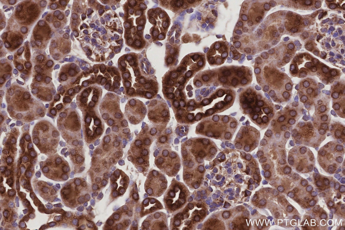 IHC staining of mouse kidney using 67205-1-Ig Immunohistochemistry (IHC) staining of mouse kidney tissue using TMEM111 Monoclonal antibody (67205-1-Ig)