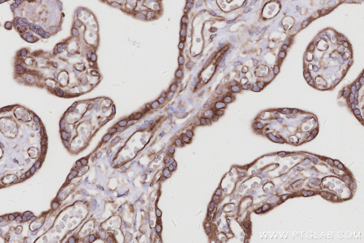 IHC staining of human placenta using 67205-1-Ig Immunohistochemistry (IHC) staining of human placenta tissue using TMEM111 Monoclonal antibody (67205-1-Ig)