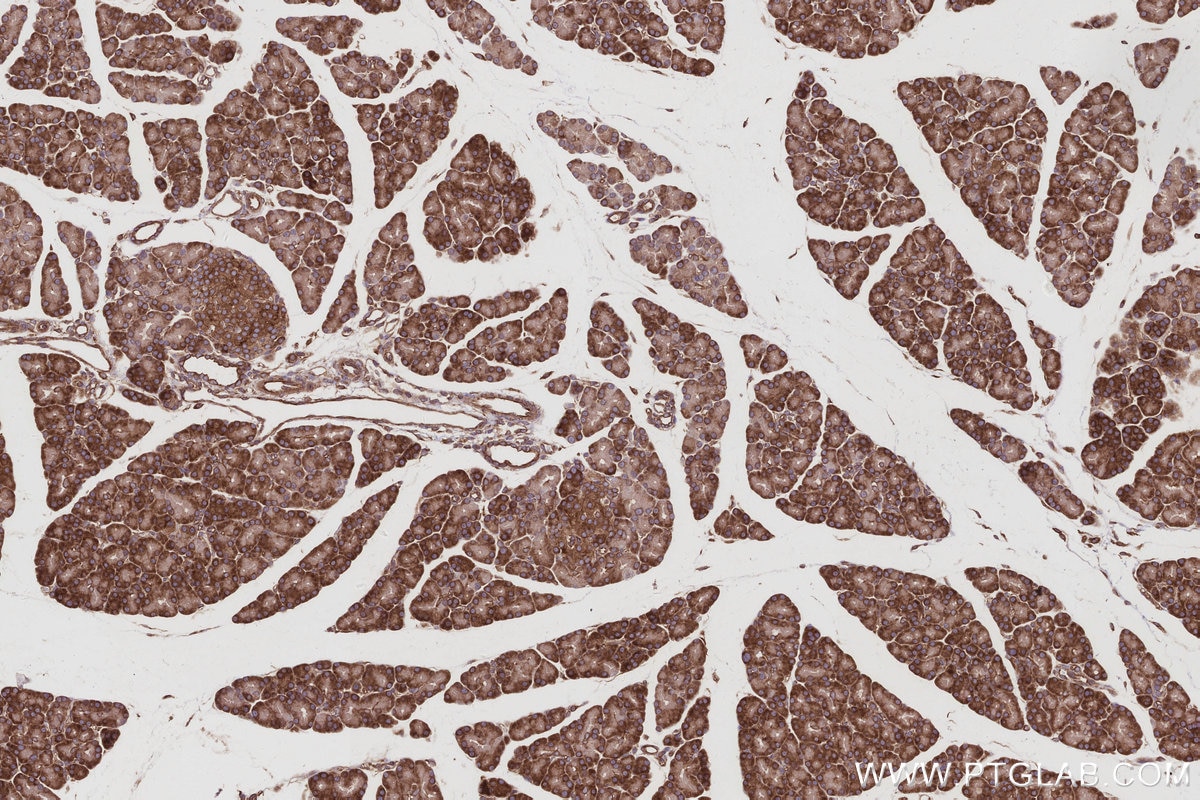 IHC staining of rat pancreas using 67205-1-Ig Immunohistochemistry (IHC) staining of rat pancreas tissue using TMEM111 Monoclonal antibody (67205-1-Ig)