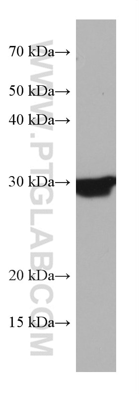 Western Blot (WB) analysis of human heart tissue using TMEM111 Monoclonal antibody (67205-1-Ig)