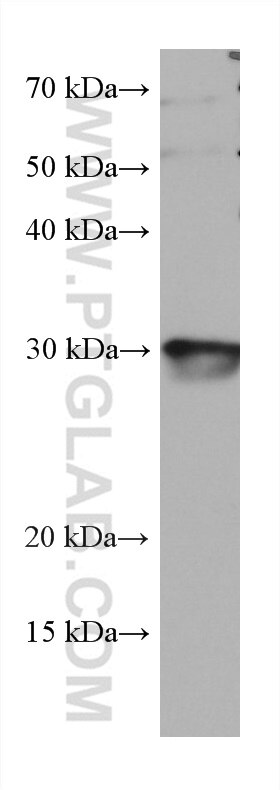 Western Blot (WB) analysis of mouse heart tissue using TMEM111 Monoclonal antibody (67205-1-Ig)