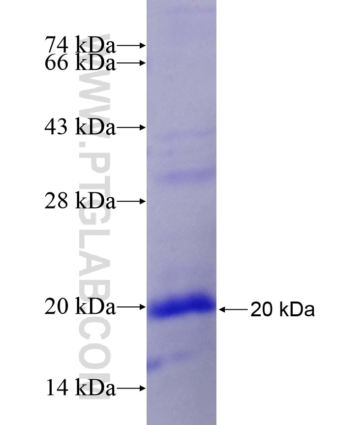 TMEM111 fusion protein Ag18365 SDS-PAGE
