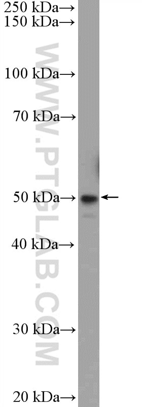 Western Blot (WB) analysis of MDA-MB-453s cells using TMEM117 Polyclonal antibody (21314-1-AP)