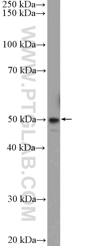 WB analysis of MDA-MB-453s using 21314-1-AP