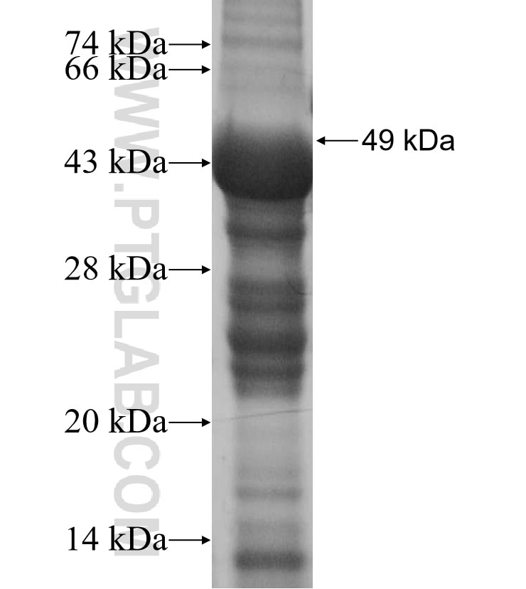 TMEM117 fusion protein Ag15966 SDS-PAGE