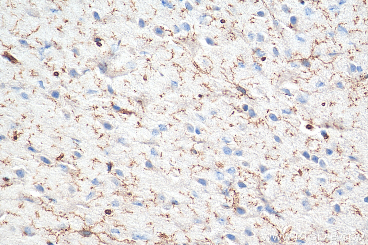 Immunohistochemistry (IHC) staining of mouse brain tissue using TMEM119 Polyclonal antibody (27585-1-AP)