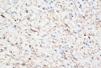 TMEM119抗体を使用したパラフィン包埋マウス脳組織の免疫組織化学染色