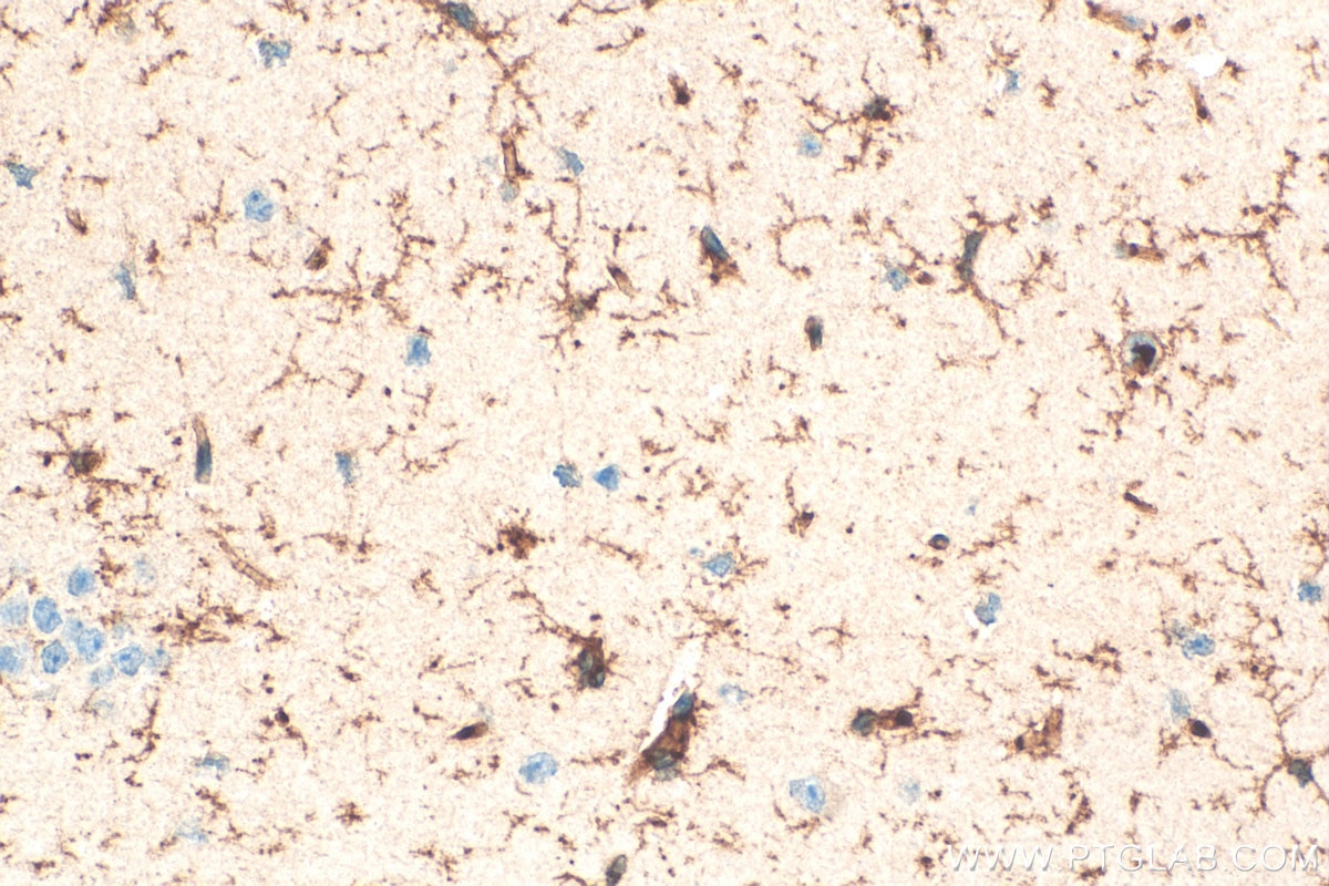 Immunohistochemistry (IHC) staining of mouse brain tissue using TMEM119 Polyclonal antibody (27585-1-AP)