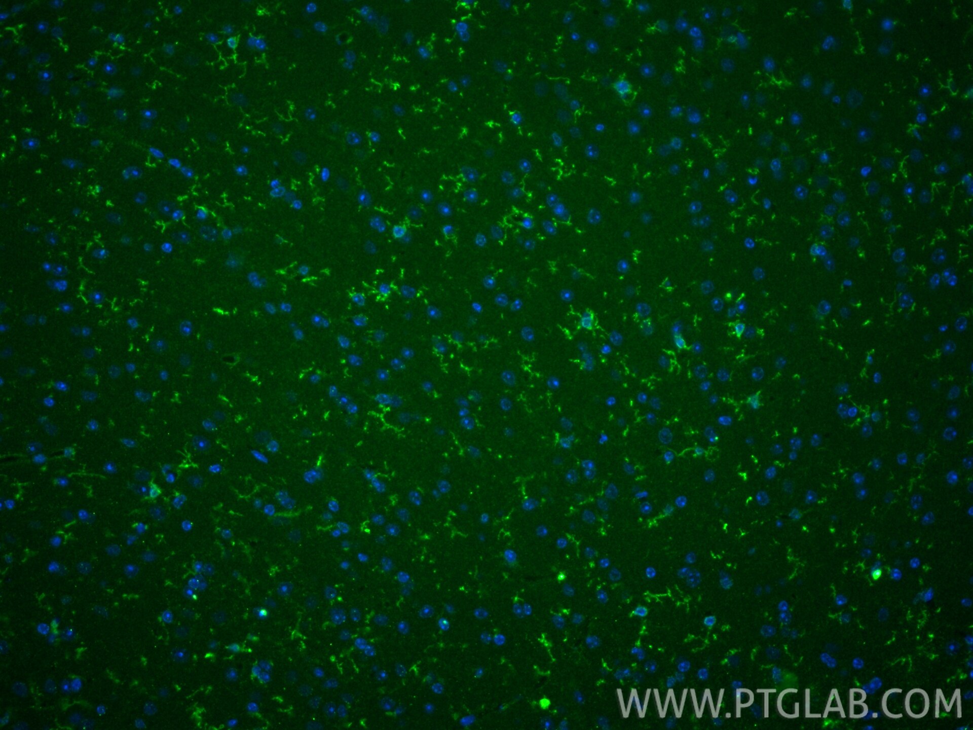 IF Staining of mouse brain using 83448-9-RR Immunofluorescence (IF) / fluorescent staining of mouse brain tissue using TMEM119 Recombinant monoclonal antibody (83448-9-RR)