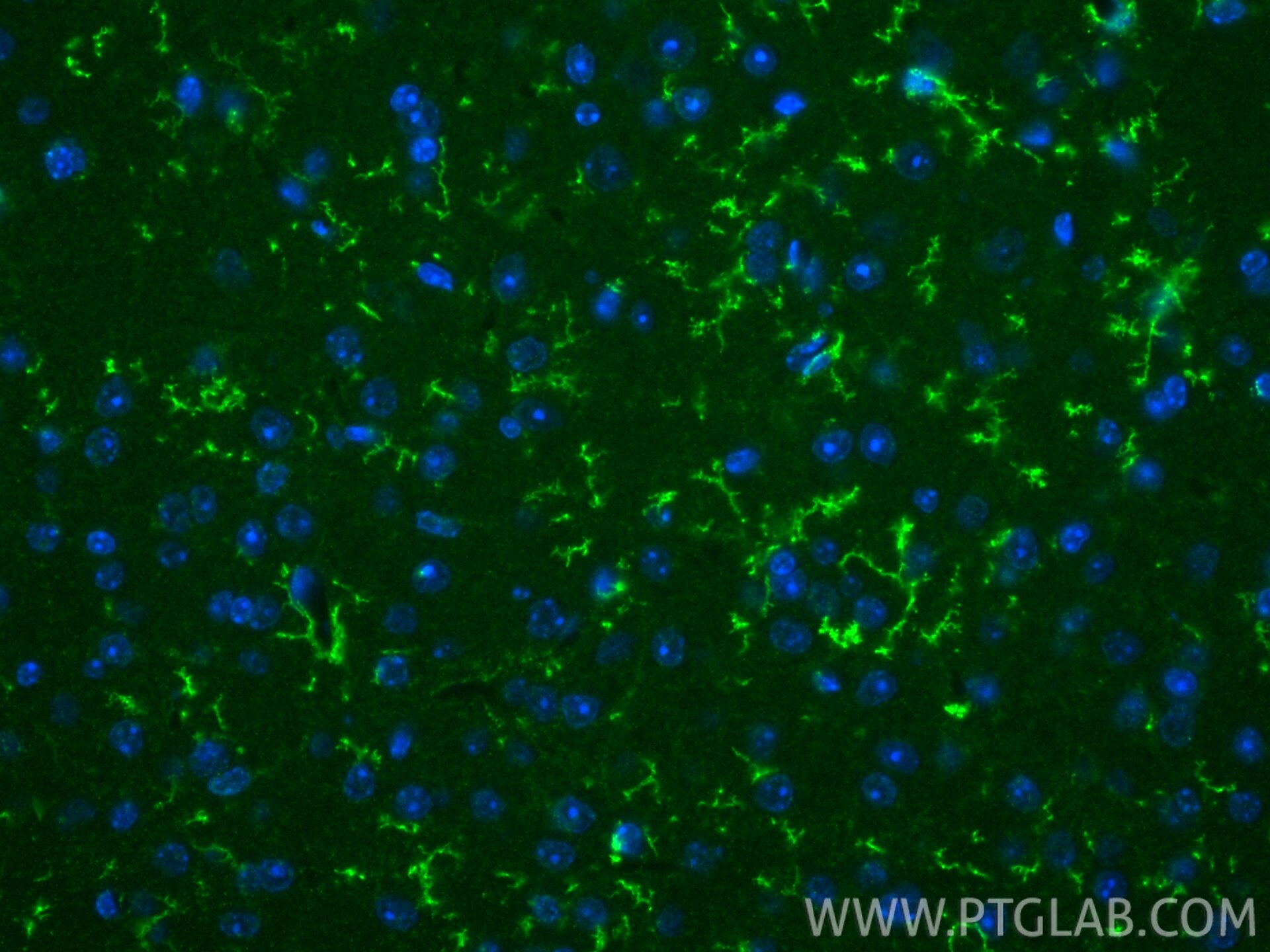 IF Staining of mouse brain using 83448-9-RR Immunofluorescence (IF) / fluorescent staining of mouse brain tissue using TMEM119 Recombinant monoclonal antibody (83448-9-RR)