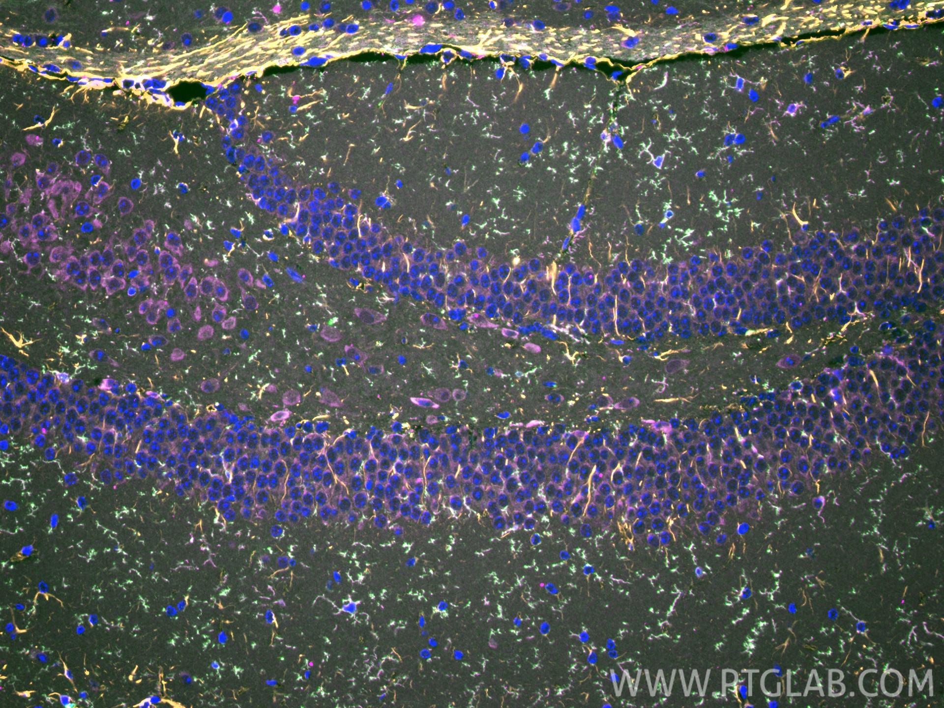 IF Staining of mouse brain using 83448-9-RR Immunofluorescence (IF) / fluorescent staining of mouse brain tissue using TMEM119 Recombinant monoclonal antibody (83448-9-RR)