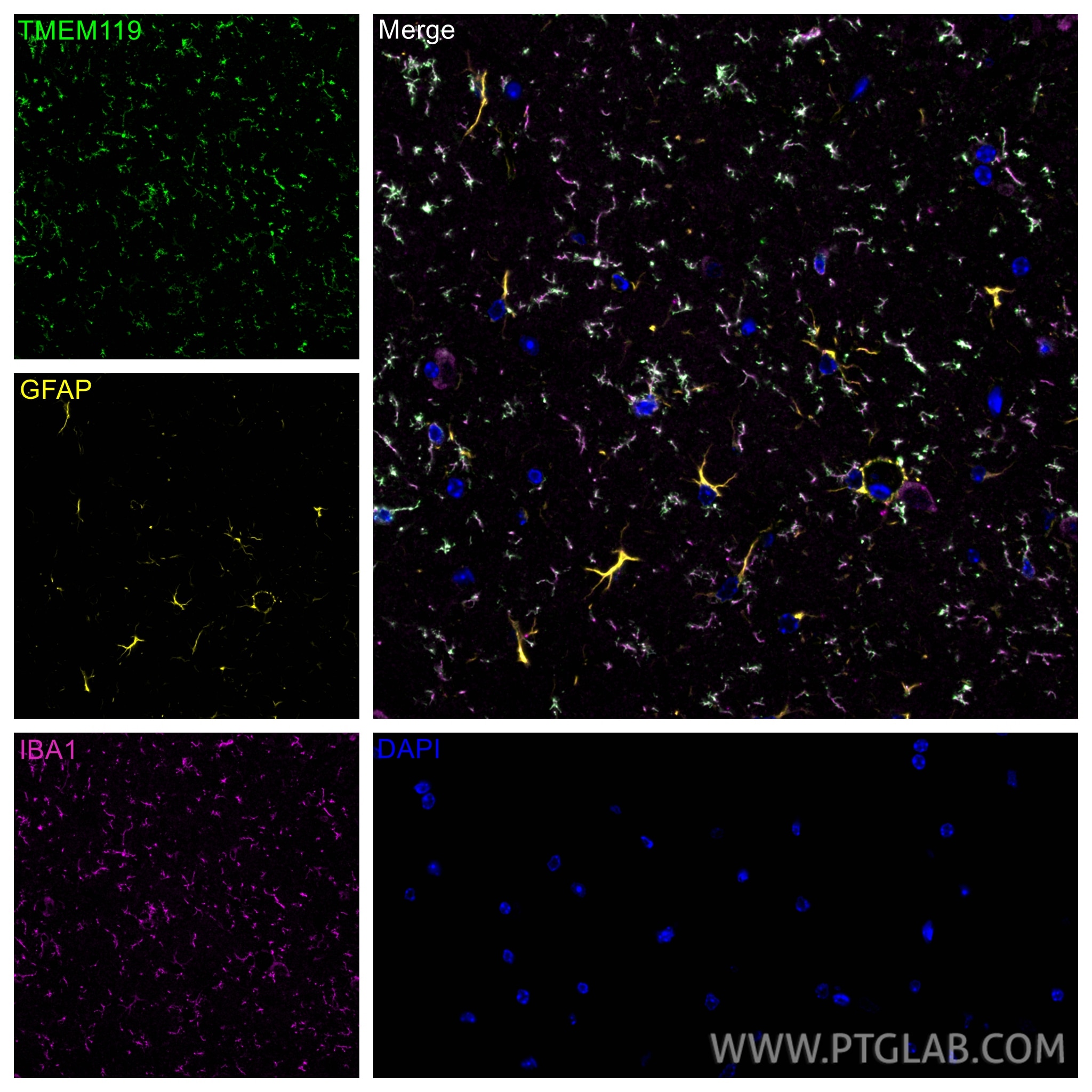 IF Staining of mouse brain using 83448-9-RR Immunofluorescence (IF) / fluorescent staining of mouse brain tissue using TMEM119 Recombinant monoclonal antibody (83448-9-RR)
