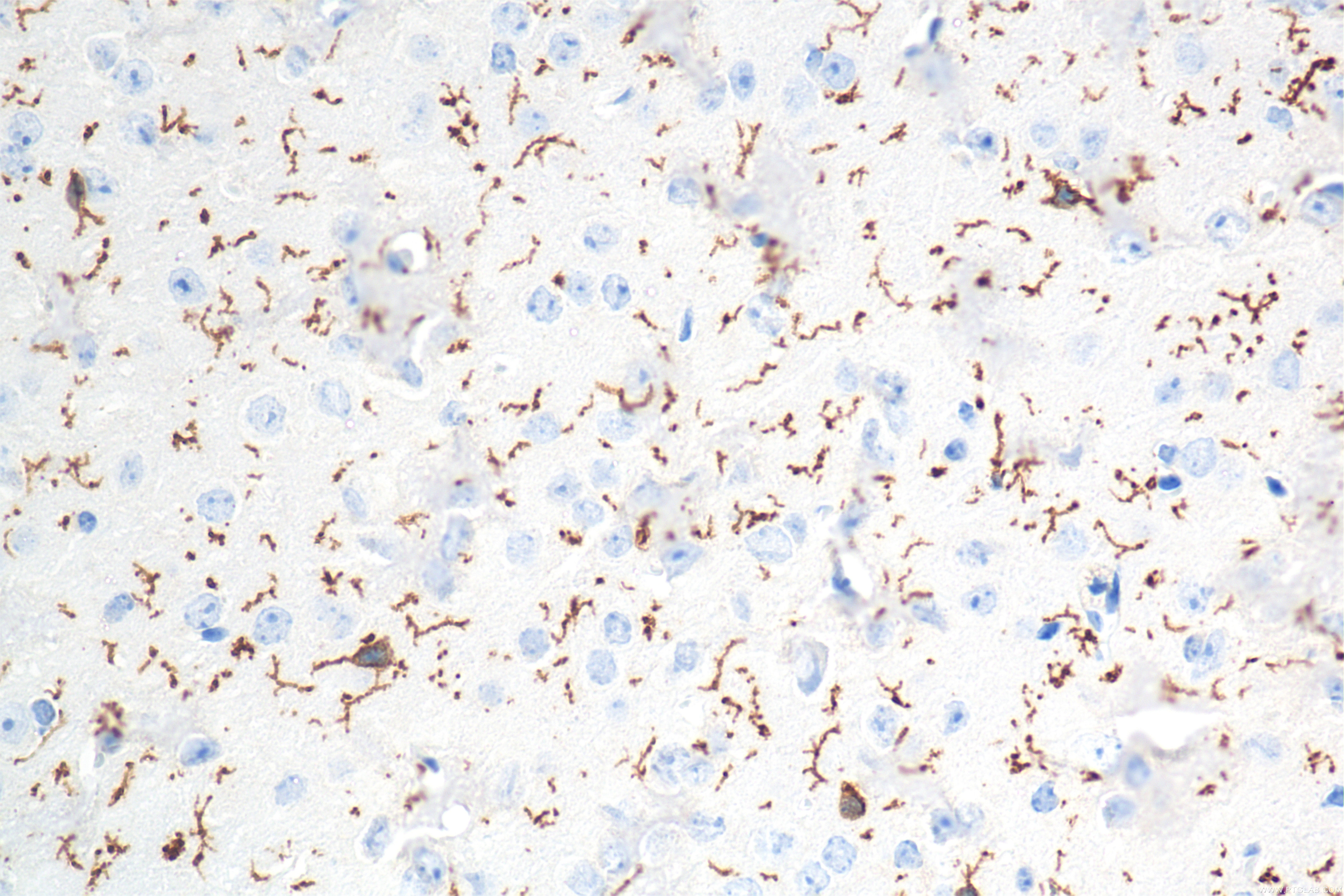 IHC staining of mouse brain using 83448-9-RR Immunohistochemistry (IHC) staining of mouse brain tissue using TMEM119 Recombinant monoclonal antibody (83448-9-RR)