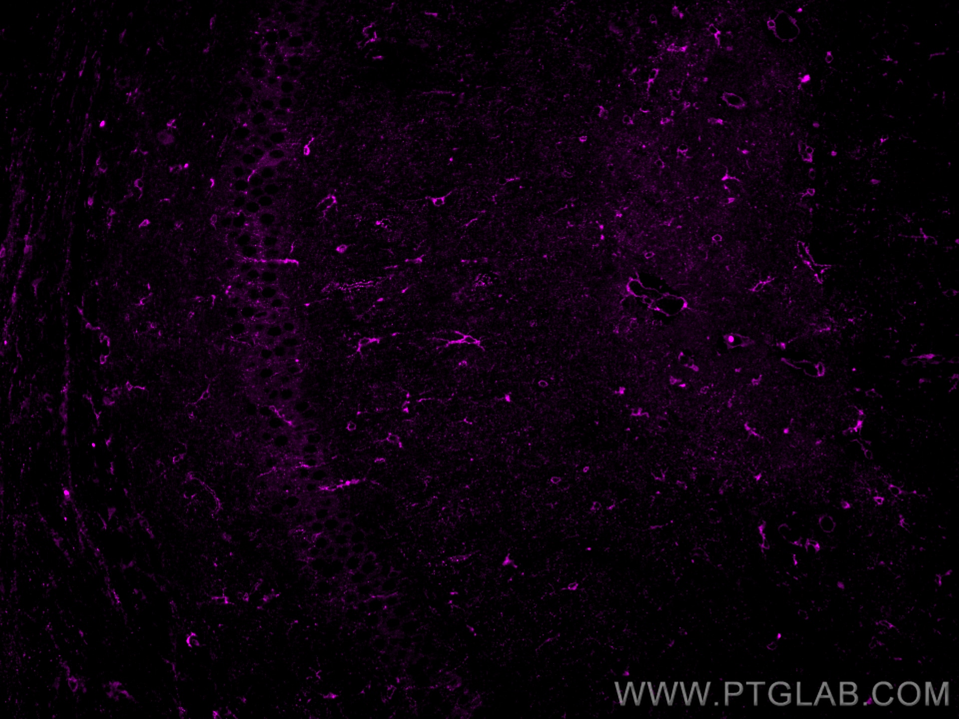 IF Staining of mouse brain using CL647-27585 Immunofluorescence (IF) / fluorescent staining of mouse brain tissue using CoraLite® Plus 647-conjugated TMEM119 Polyclonal a (CL647-27585)