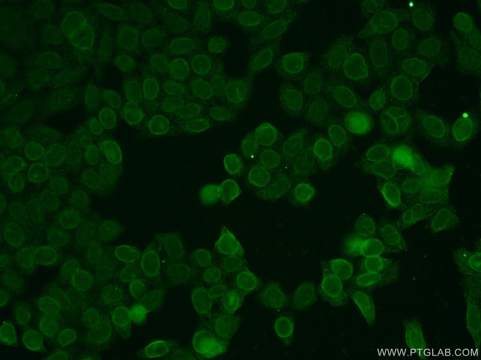 Immunofluorescence (IF) / fluorescent staining of HeLa cells using TMEM120A Polyclonal antibody (17455-1-AP)