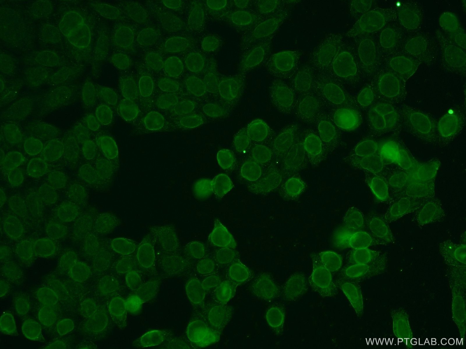 IF Staining of HeLa using 17455-1-AP