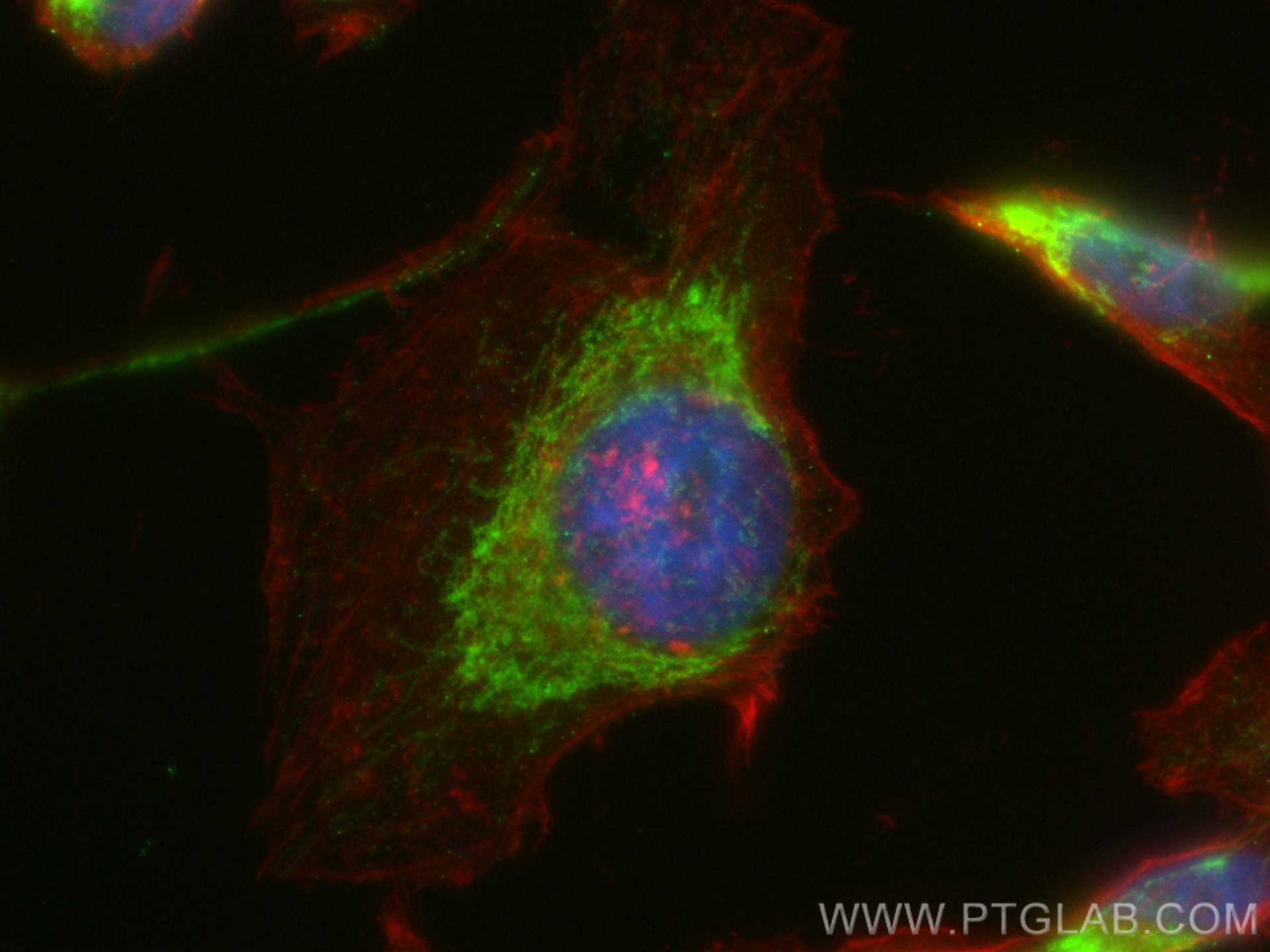 Immunofluorescence (IF) / fluorescent staining of HeLa cells using TMEM126A Polyclonal antibody (20759-1-AP)