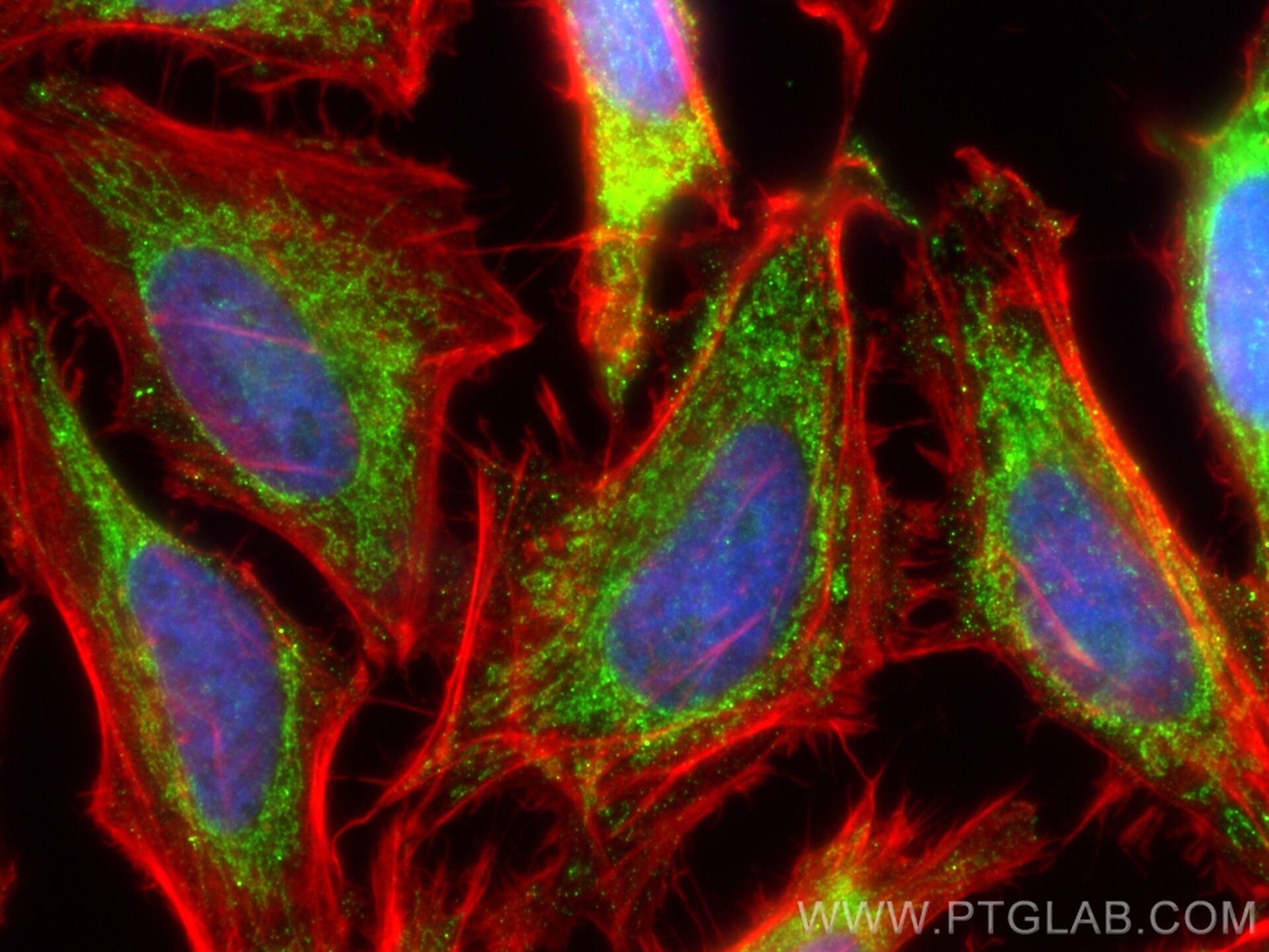 Immunofluorescence (IF) / fluorescent staining of HeLa cells using TMEM126A Polyclonal antibody (20759-1-AP)
