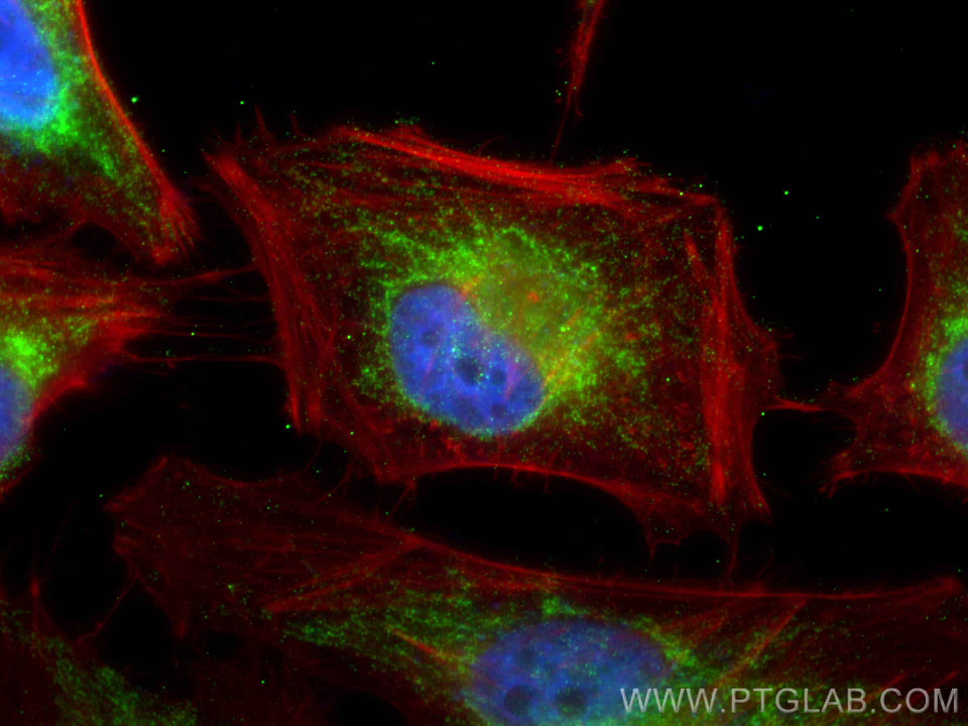Immunofluorescence (IF) / fluorescent staining of HeLa cells using TMEM126A Recombinant antibody (83440-2-RR)