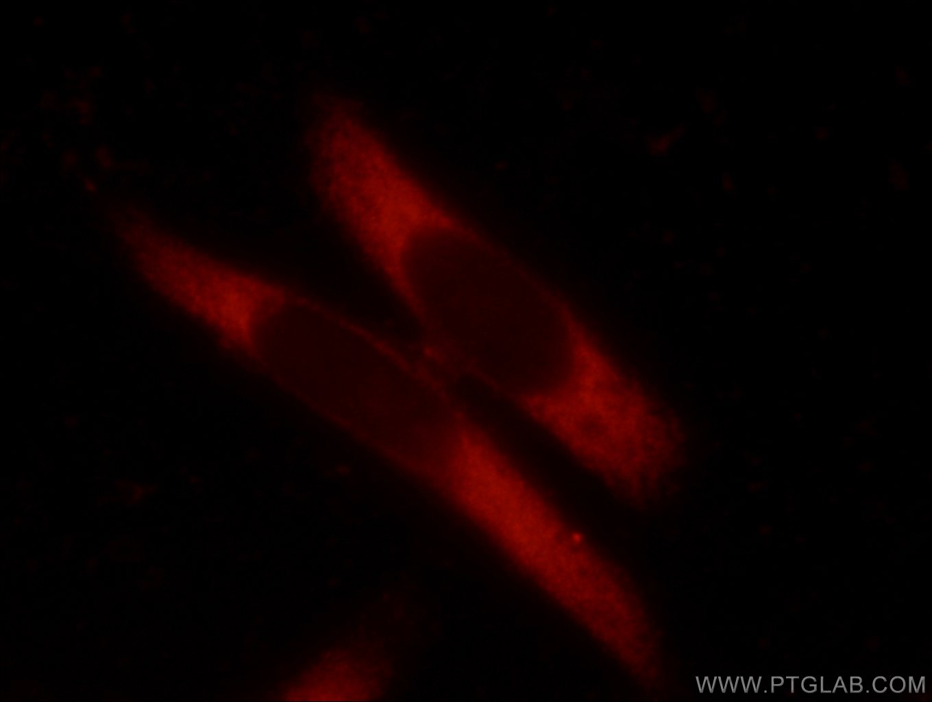 Immunofluorescence (IF) / fluorescent staining of HeLa cells using TMEM127 Polyclonal antibody (23142-1-AP)