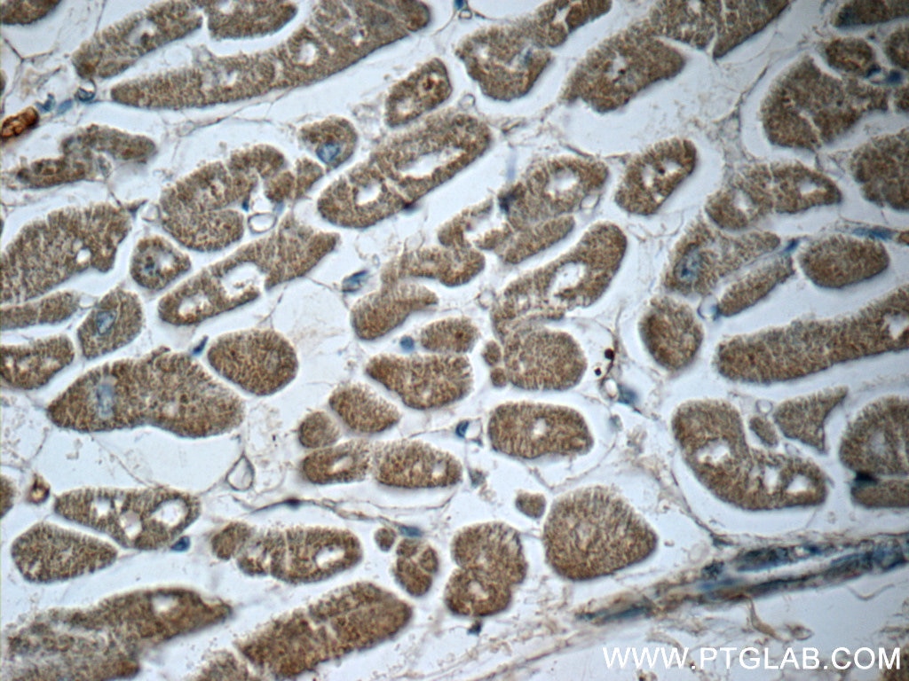 Immunohistochemistry (IHC) staining of human heart tissue using TMEM127 Polyclonal antibody (23142-1-AP)